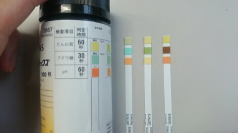 臨床検査技師養成科】 1年生尿タンパク検査 | 新潟県北里大学保健衛生専門学院の学院ブログ